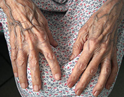 ГСК «Югория» в Советском заключила договор с домом-интернатом «Дарина»